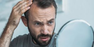 man with hair loss